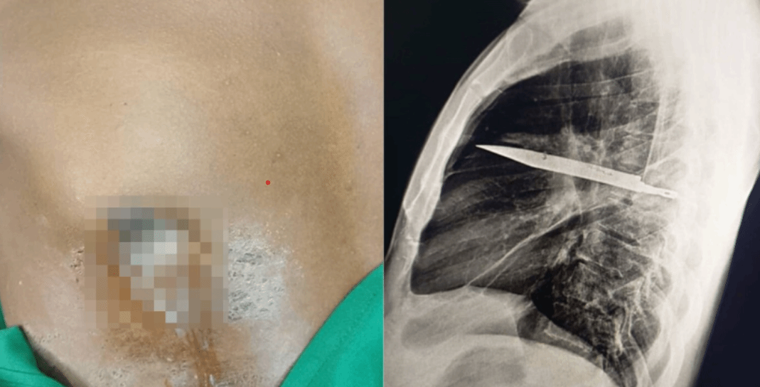 御三家Game-undefined